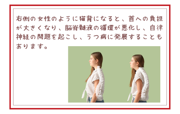 右側の女性のように猫背になると、首への負担が大きくなり、脳脊髄液の循環が悪化し、自律神経の問題を起こし、うつ病に発展することもあります。